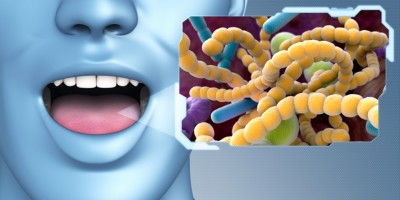Patient Mouth, Bacteria in the mouth